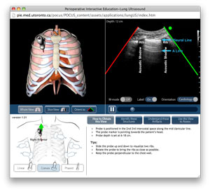 screen capture of lung ultrasound module